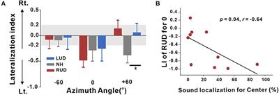 Corrigendum: Ear-Specific Hemispheric Asymmetry in Unilateral Deafness Revealed by Auditory Cortical Activity
